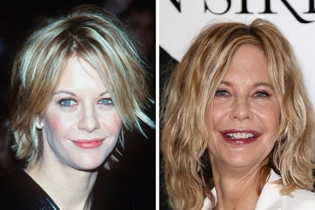 A picture of Meg Ryan before (left) and after (right).